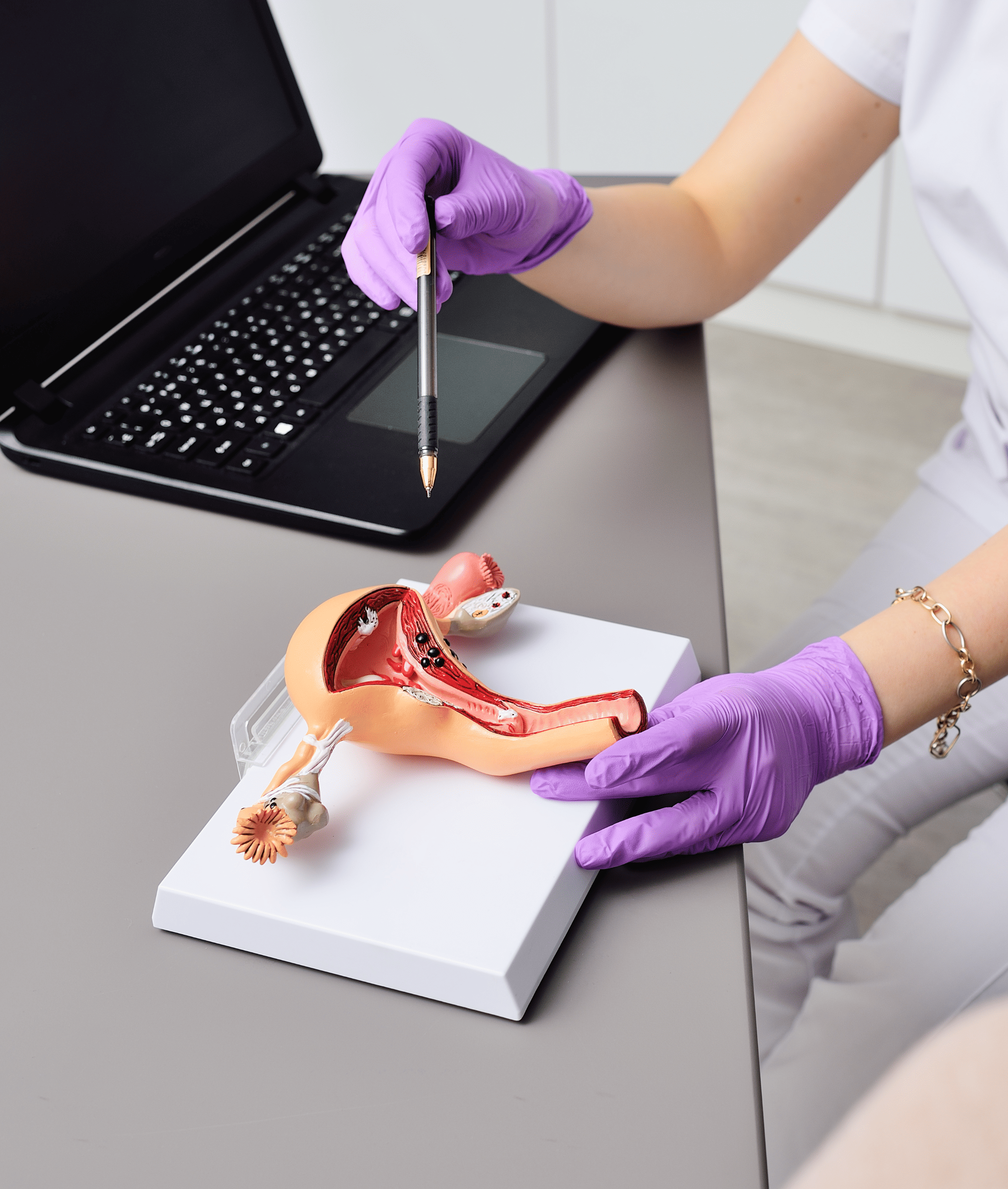 clínica endometriosis centro médico toluca